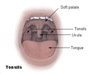 Tonsils_diagram.jpg