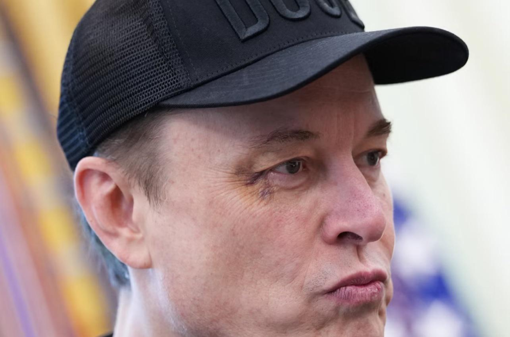 Elon Musk eye injury