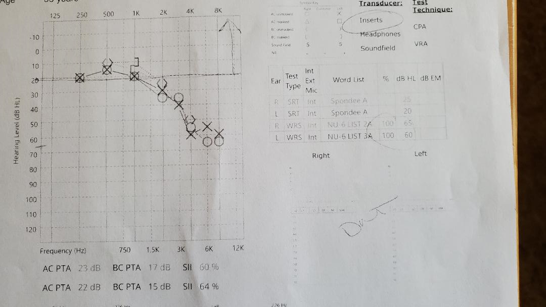 hearingTest_part1_s.jpg