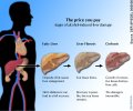 Liver[1].jpg