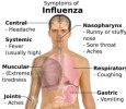 Symptoms_of_influenza.jpg