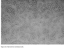 hydrogelnormalbloodcells5.png