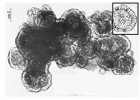 An-electron-micrograph-of-a-structure-resembling-a-clump-of-viruses-influenza-virus-also_W640.jpg