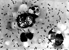 bubonic-plague-smear-demonstrating-the-presence-of-yersinia-pestis-bacteria.jpg