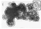 An-electron-micrograph-of-a-structure-resembling-a-clump-of-viruses-influenza-virus-also_W640.jpg