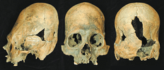 Different-views-of-cranium-of-Late-Preclassic-Burial-1A-Tlaltenco-Mexico-City.png