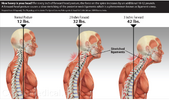 tech neck 1.png