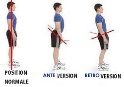 Retroversion_anteversion-1.jpg