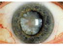 www.reviewofoptometry.com