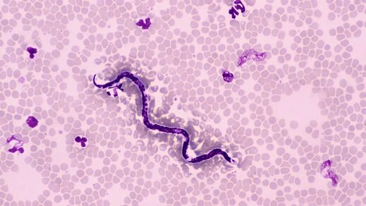 parasite