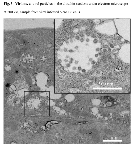 coronavirus microscope