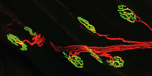 neuromuscular