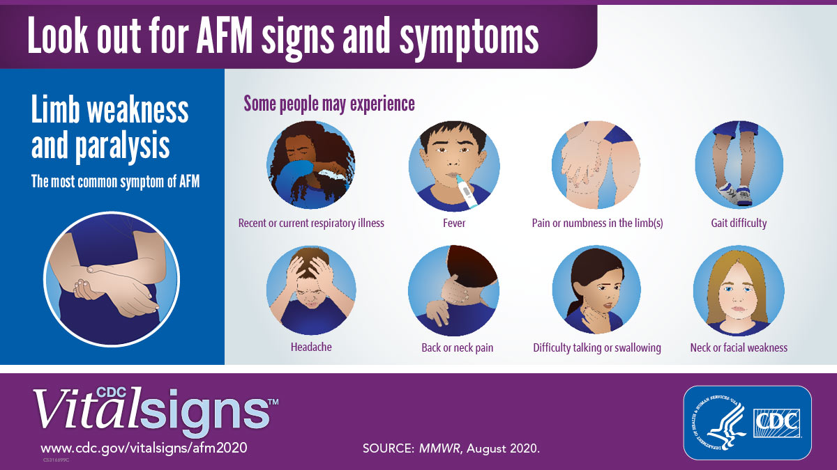 Infographic showing the signs and symptoms of Acute Flaccid Myelitis