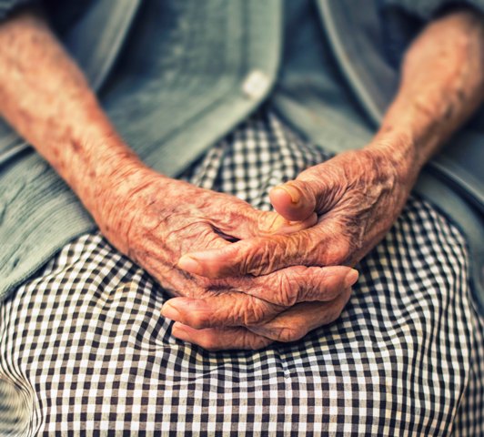Photo of female arthritic hands