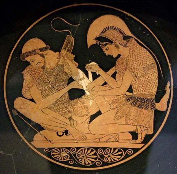 Achilles tending Patroclus wounded by an arrow, identified by inscriptions on the upper part of the vase. Tondo of an Attic red-figure kylix, circa 500 BC. From Vulci. (Public Domain)