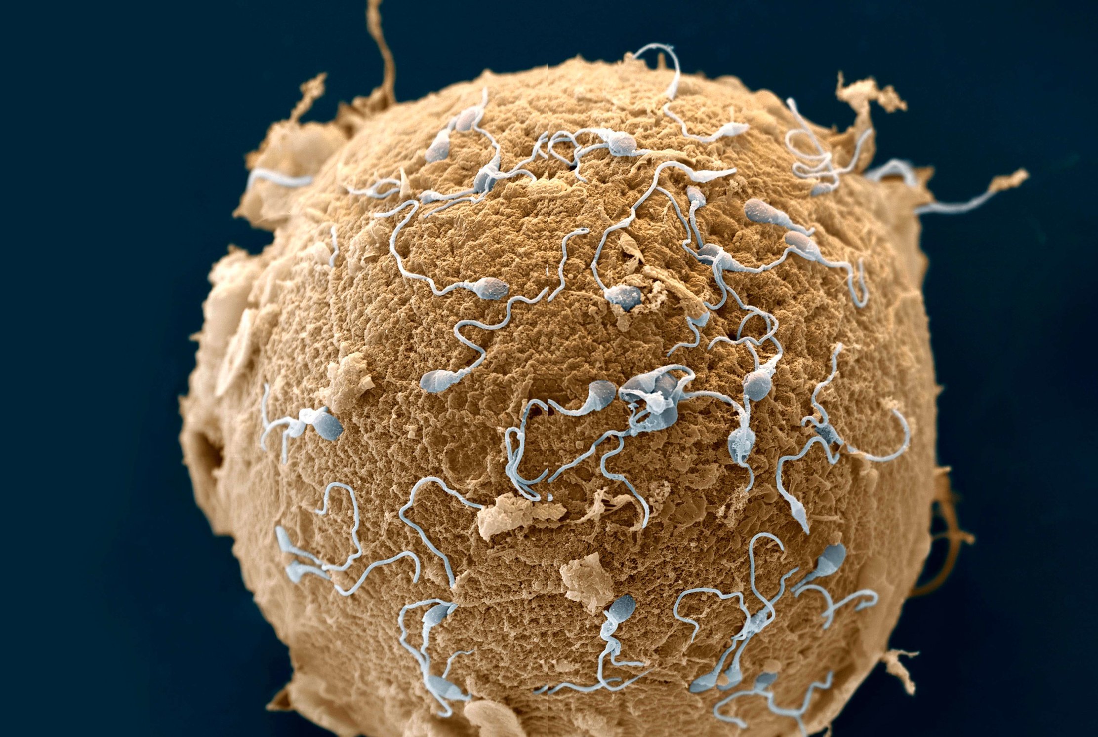 reproduction-chaque-ovule-attire-les-spermatozoides-prefere.jpg